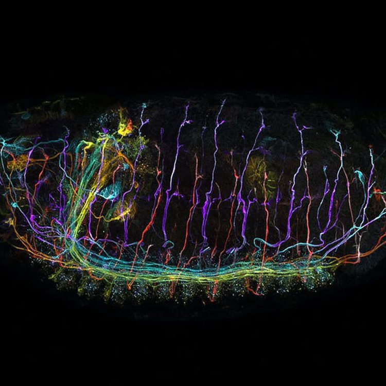梅州共聚焦显微镜
